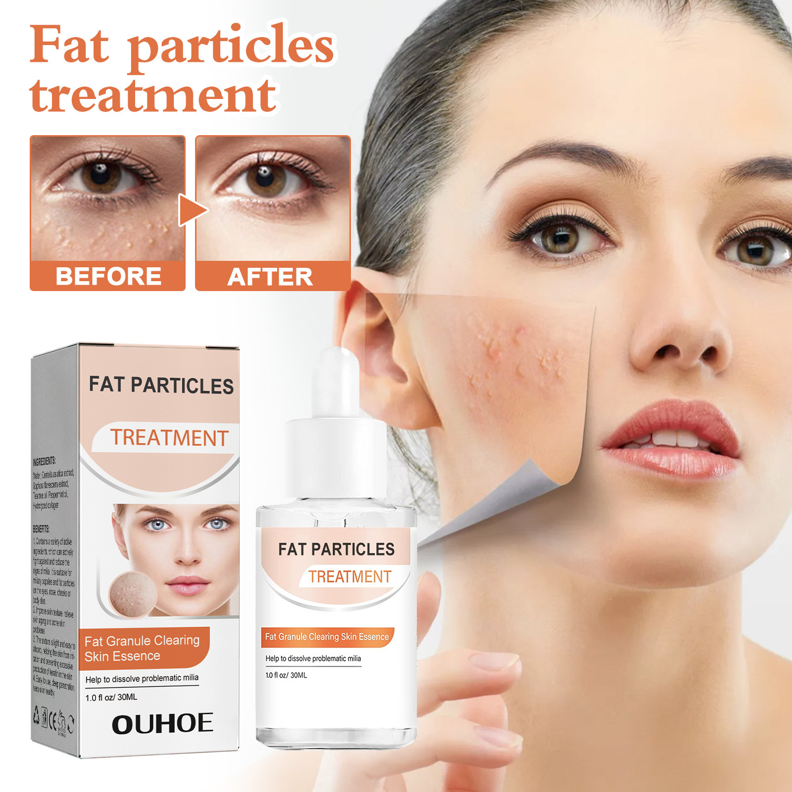 Ouhoe Millet Seed Care Essence Moisturizes and Cares for Millet Seed Acne, Moisturizes and Cares for Delicate Skin and Pores