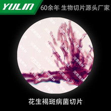 �����ְ߲�����Ƭ�����@΢�R�˱�����ֲ�：���d��Ƭ�^�쌍��У