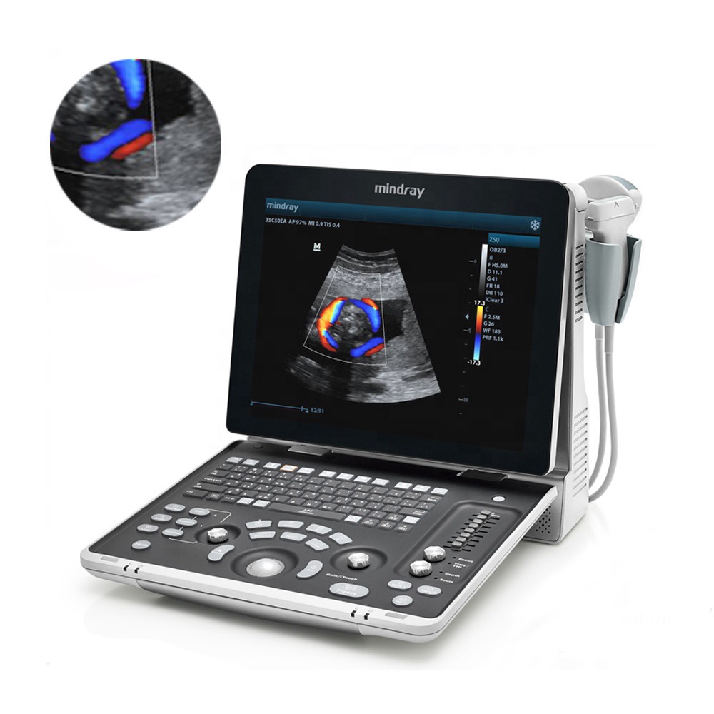 Mindray Z50 Imagen 3D/4d Color Doppler Ultrasonido de diagnóstico en la clínica del hospital