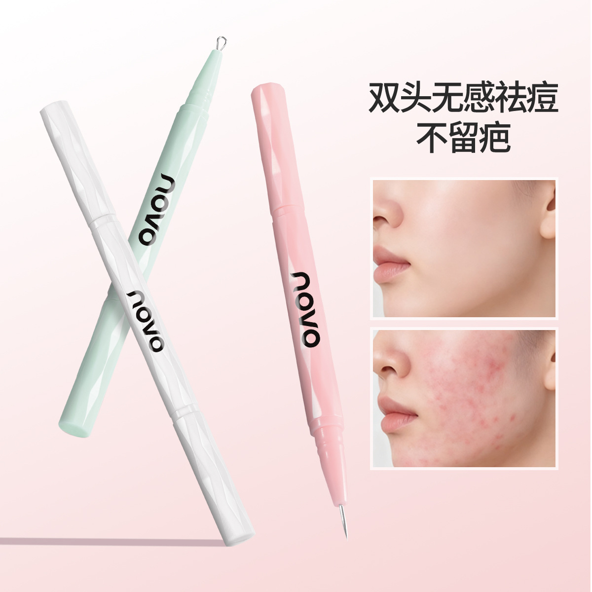 NOVO9252清颜带盖双头粉刺针纤细钢针 头，钢圈二合一双头设计