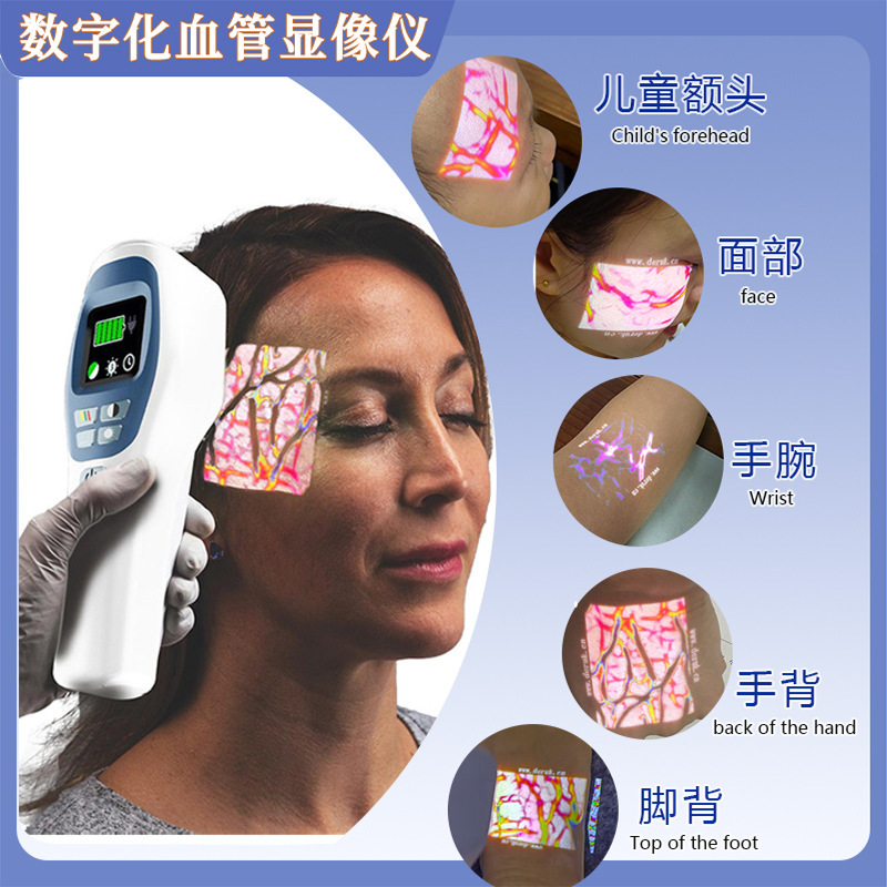 外国貿易静脈血管検出器医療顔/腕血管検出器投影血管検出器|undefined