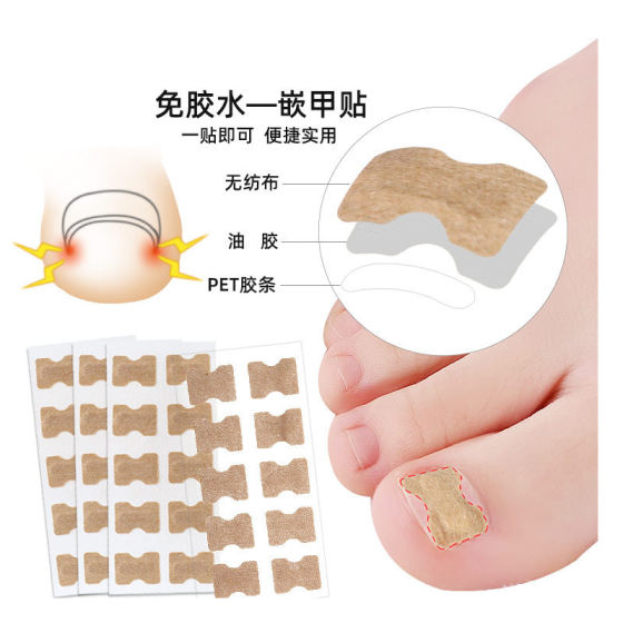 Nail nail correction nail nail correction nail nail correction nail correction nail correction repair patch repair toe inner nail