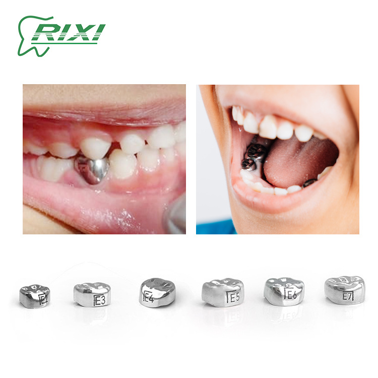 Corona dental infantil de acero inoxidable preformada de dientes de leche infantil material temporal de relleno de dientes de leche conjunto de corona moldeada