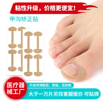 指甲矫正贴甲沟指甲矫正贴片加粘嵌甲矫正贴指甲纠正脚趾甲正甲贴