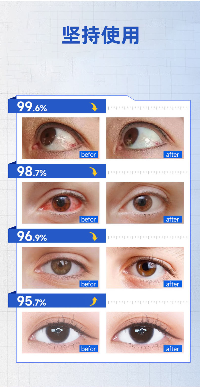Lutein Blueberry Eye Care Spray Gentle Portable External Eye Area Mist 90ml preparation