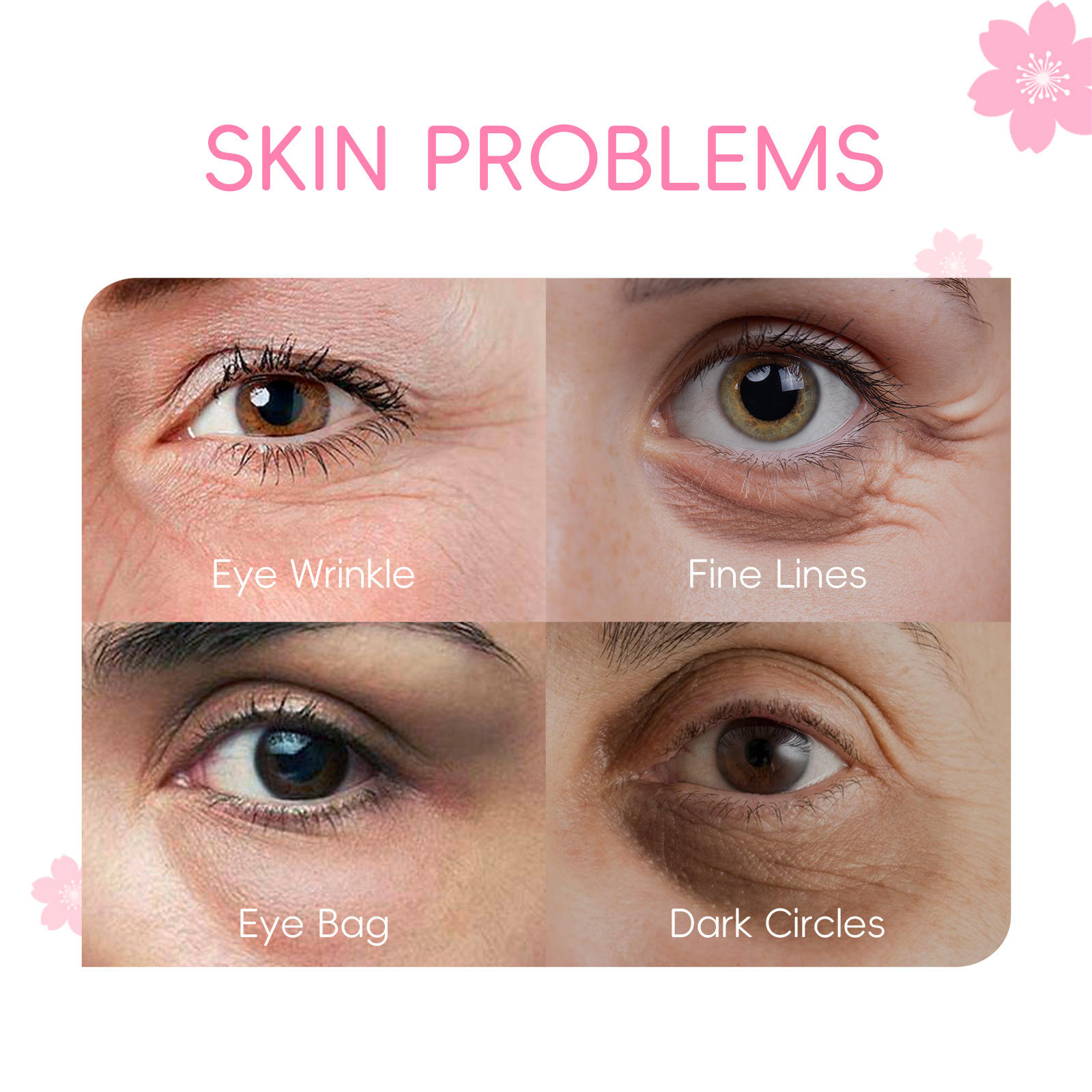 Cross-border Fenyi Cherry Blossom Eye Serum 15ml Hydrates, moisturizes and cares for the skin around the eyes. Manufacturer's supply undefined
