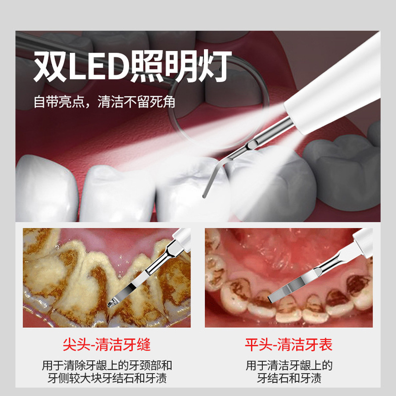 Limpiador de dientes eléctrico hogar diente escala eliminación diente amarillo piedra instrumento de eliminación visual ultrasónico Nuevo limpiador de dientes