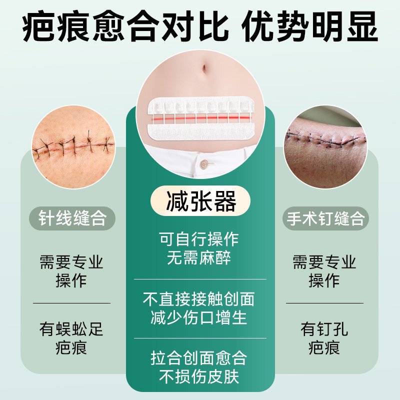 妥能弹性绑带（无纺布）绷带拉合皮肤缝合器拉链式创口贴减张器|undefined