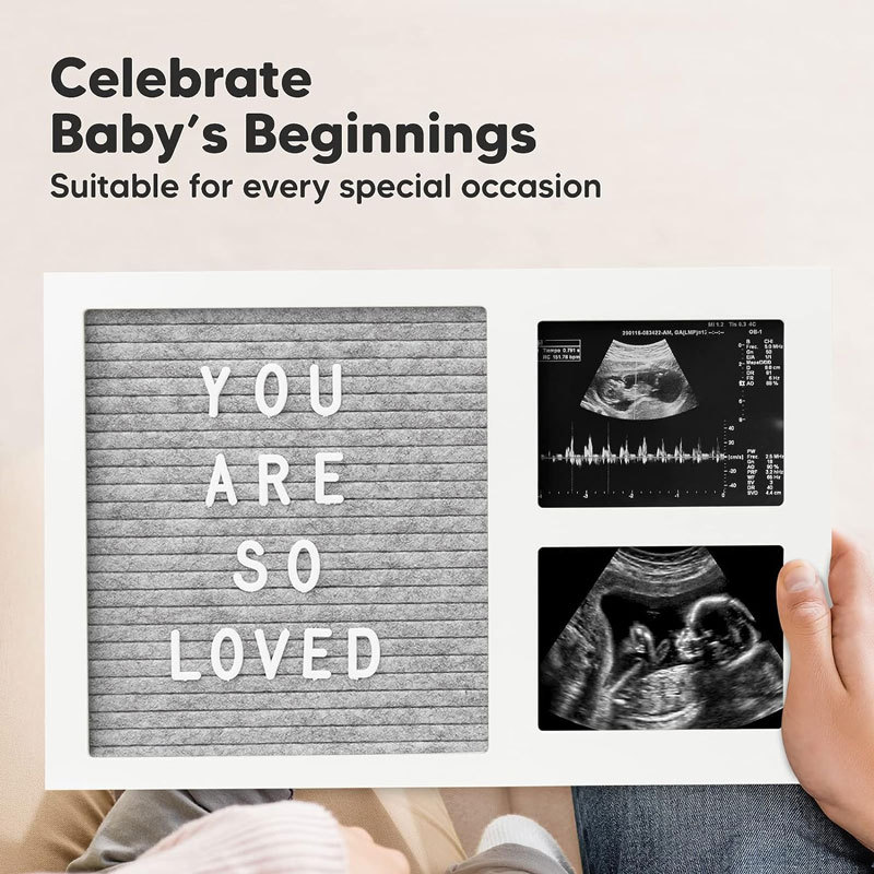 Marco de Fotos Creativo de Madera del Fabricante, Decoración de Dormitorio, Marco de Fotos de Fieltro, Recuerdo de Ecografía de Bebé, Recuerdo de Embarazo