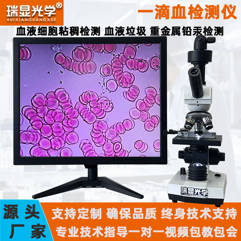 A drop of blood detector blood cells sperm aquaculture skin mite detection portable microscope with screen