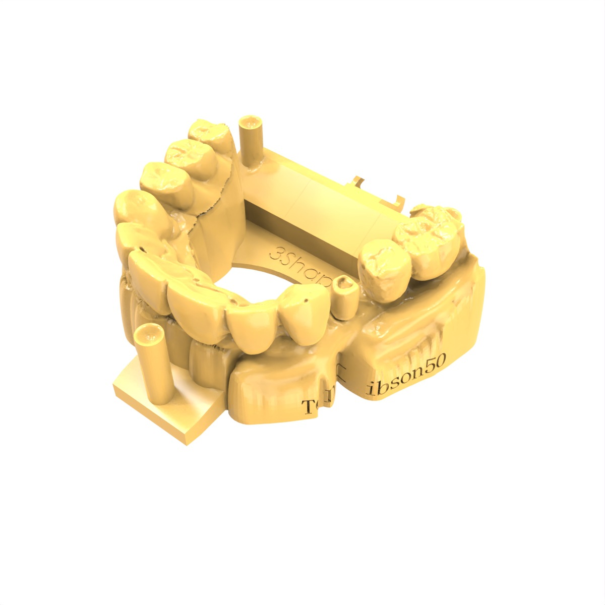 数字化牙科修复光固化树脂 | 高精度3D打印光敏树脂