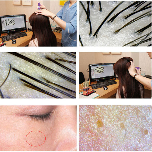 Wi-Fi Phone Computer Skin Detection Instrument Skin Hair Scalp Hair Hair Follicle Tester High-Definition Camera