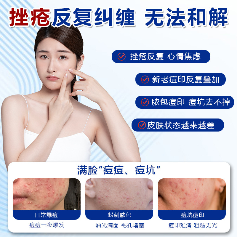 德国靡浩览娅玫瑰痤疮膏暗沉痤疮痘痘痘坑痘印修复膏护理膏清洁膏|undefined