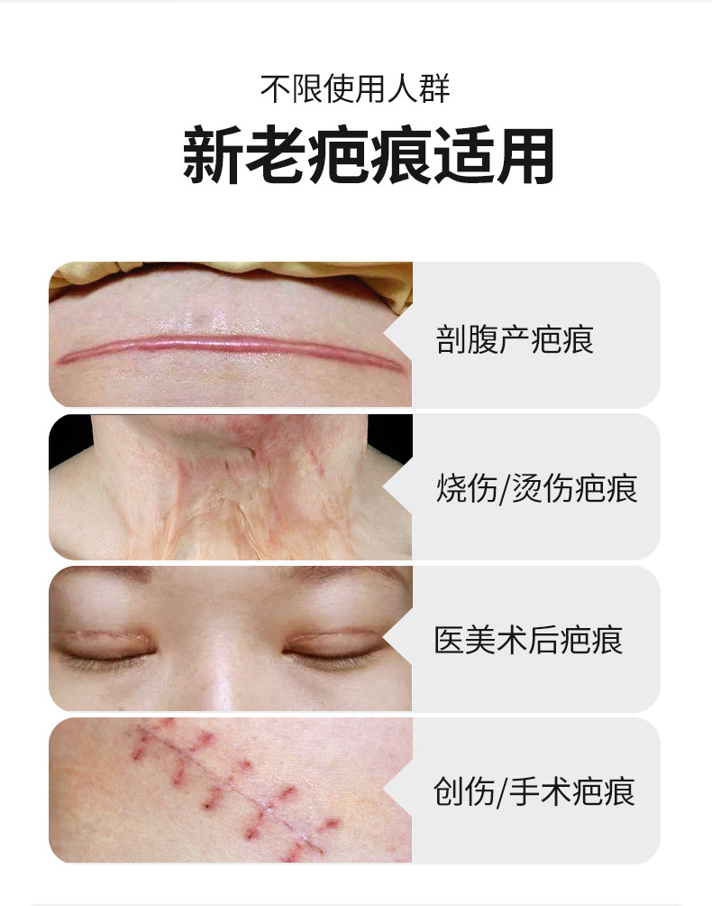 疤痕贴组合详情-22_04.jpg