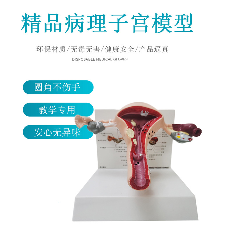 Human Anatomical Model of Uterine Lesion Female Reproductive System Reproductive Structure Gynecological Eggs Display Teaching Aids
