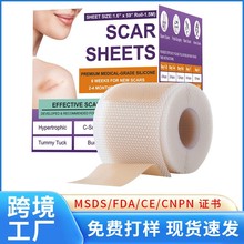 �羳���� �̺���Silicone Sca Sheets1.5m�����滺�˰�Ƥ���轺