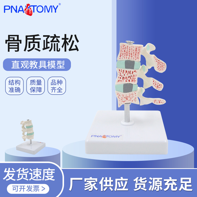 Human Skeleton Osteoporosis Pathological changes Model Vertebra cervical vertebra anatomy Model joint Model Skeleton Model