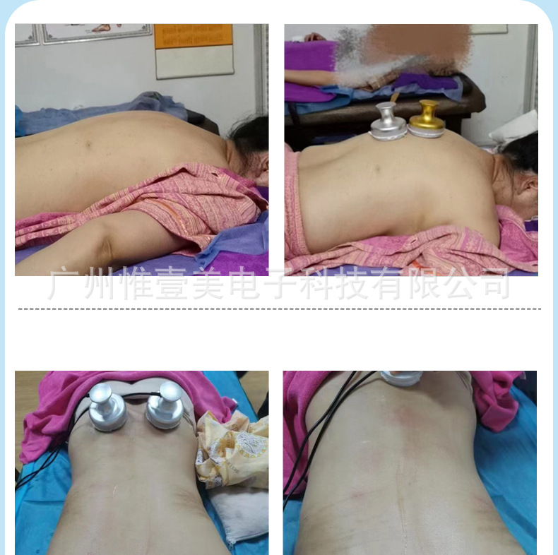 灸导仪无违禁词_14.jpg