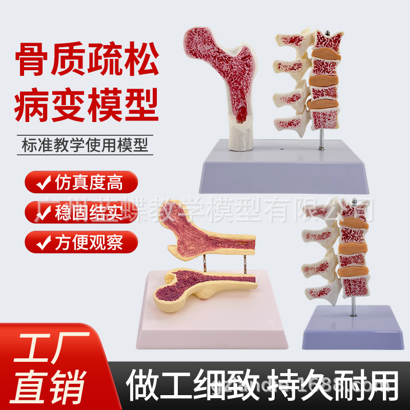 ����ɹǹ������ɽ���ģ���ȹǽ����� ��������걾 ������׵ģ��