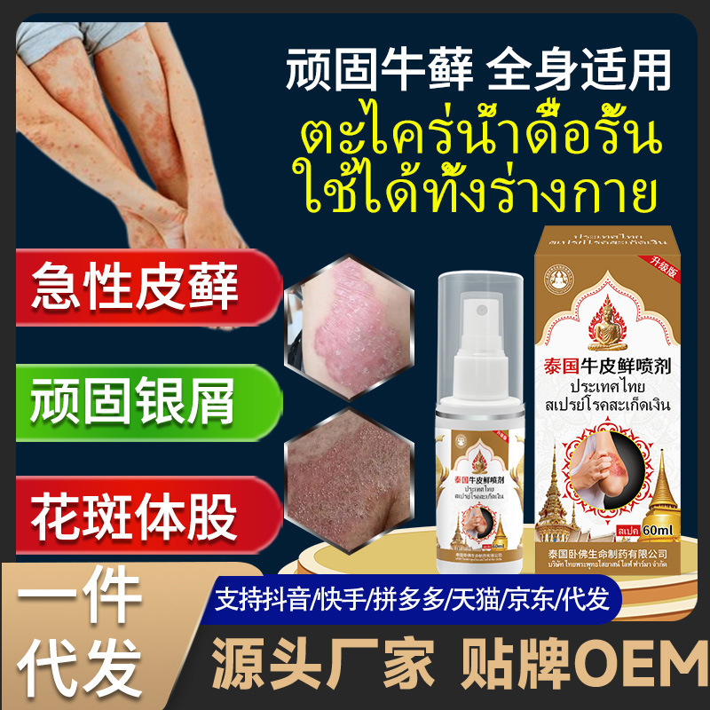 タイの臥仏の牛のコケの銀の頭の皮の白癬は菌を診察して皮膚のかゆみに感染して頑固な牛のコケのかゆみを止めますスプレー|undefined