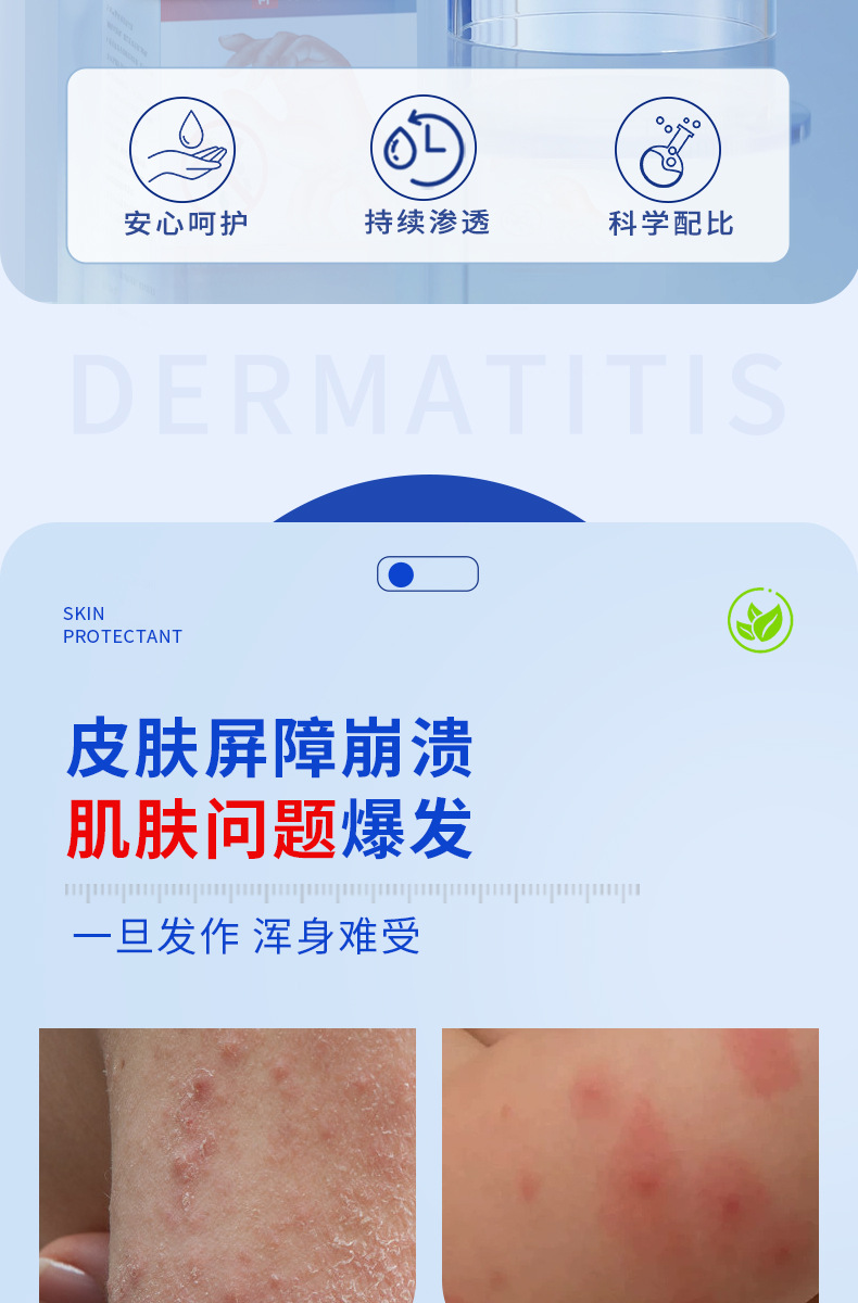 Dermatitis Eczema Gel External Herbal Topical for Itchy Skin and Joint Discomfort 黔械注准20252090184 quality and texture
