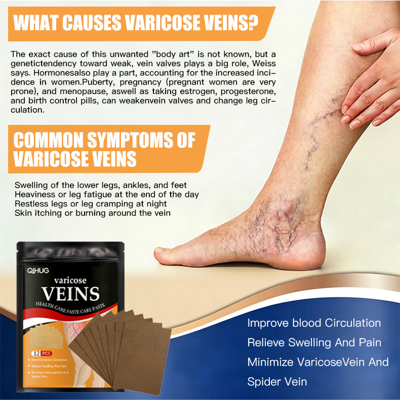 Varicose Vein Care Paste Patches Leg Support 12 Patches Per Pack External Use preparation