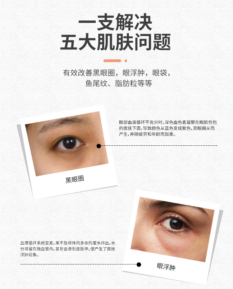 New Eye Beauty Device Eye Essence Introduction Machine Electric Beauty Instrument Anti-Wrinkle Acne Treatment Dark Circle Removal Massage Machine Wholesale Firming