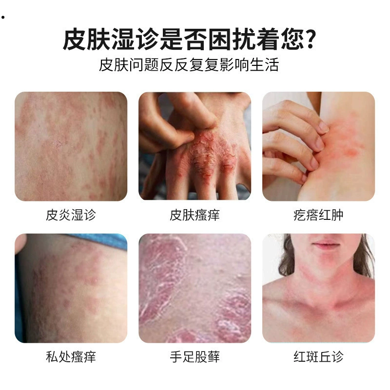 Влажная диагностика для взрослых противозудный внешний хронический упрямый дерматит