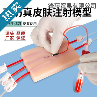 ����Ƥ�w��Ѫ��Ѫ�����t�W���oʿ���ݔҺY���o�}ע�䴩��ģ�Ͱ�