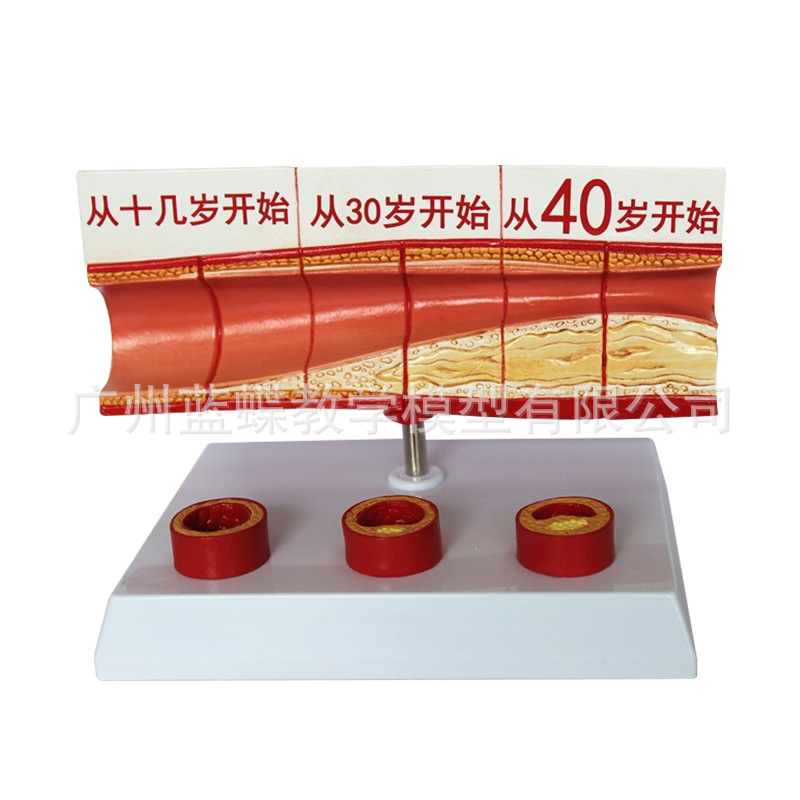 ����Ѫ�ܽ���ģ�� Ѫ��ģ�� ����/Ӳ��չʾ ���׶������Ѫ��չʾ