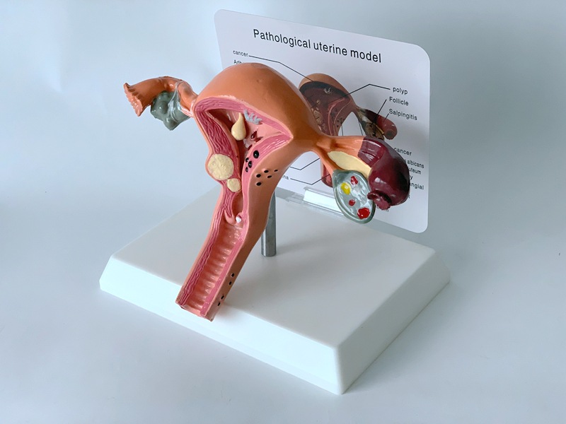 软胶生殖模器模型女性生殖模器模型私密子宫模型教具妇科卵巢病理