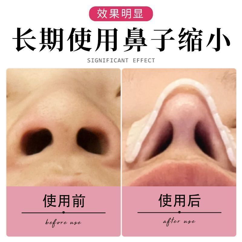 鼻整形手術後の鼻固定具、鼻梁をまっすぐにする、鼻翼を自分で捏ねて整形する、鼻を引っかかれないようにするツール|undefined