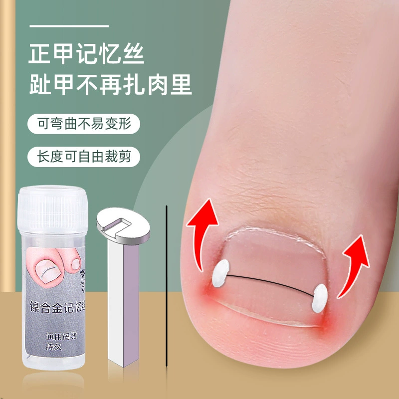 Рулонный Ортез для ногтей никель Цинь сплав памяти отскок паста для ногтей паз для ногтей вросший ноготь патч для ногтей на ногах длинная подкладка для мяса