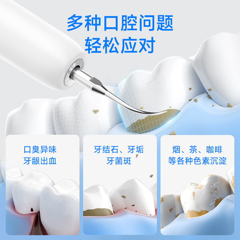 月の曲がりくねった超音波スケーラー家庭用知能超音波洗歯器除歯石個人看護美歯器
