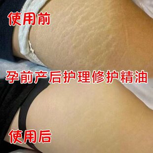 ���֮a���Ѽy�����ޏ�˪���мy�A�����ּy���L�o���ո�ȥ���L��Ħ