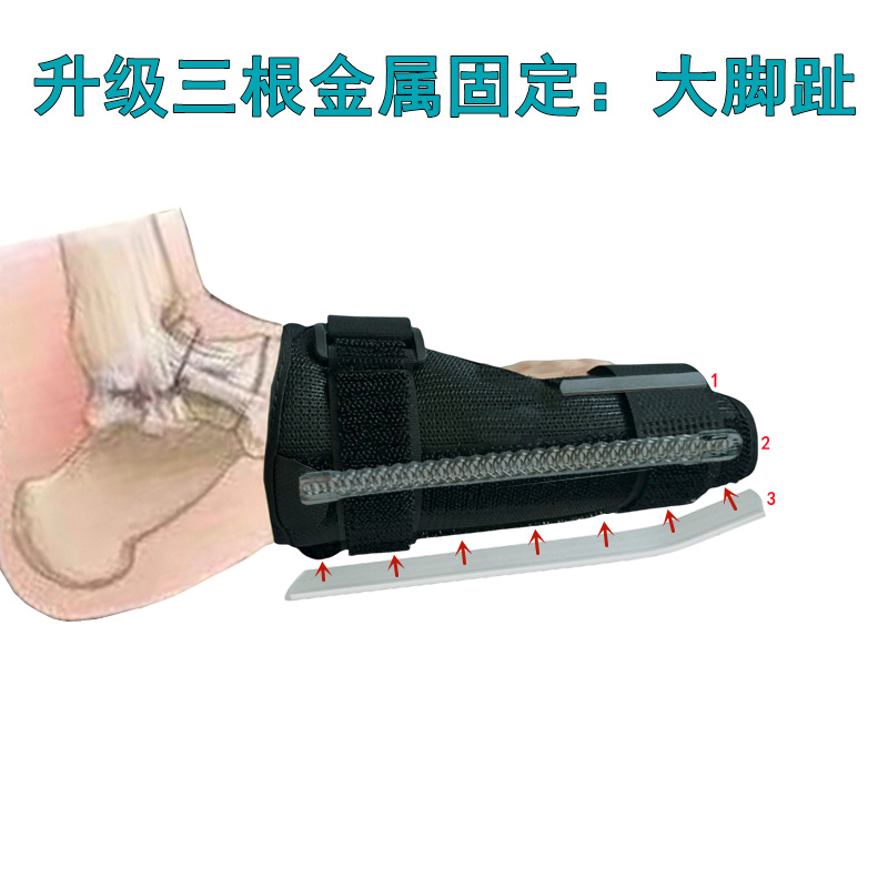 脚趾护具大脚拇指固定器小夹板骨折拇外翻分趾器脚趾套工地专用