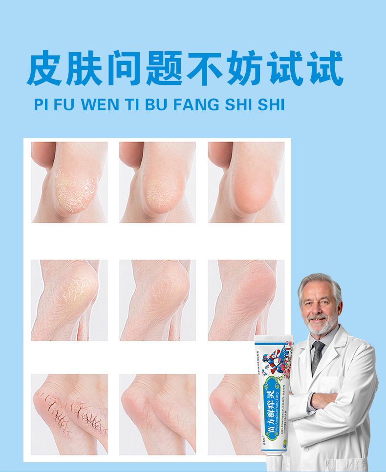 Miao Fang Herbal Skin Ointment External Topical Cream 20g in use