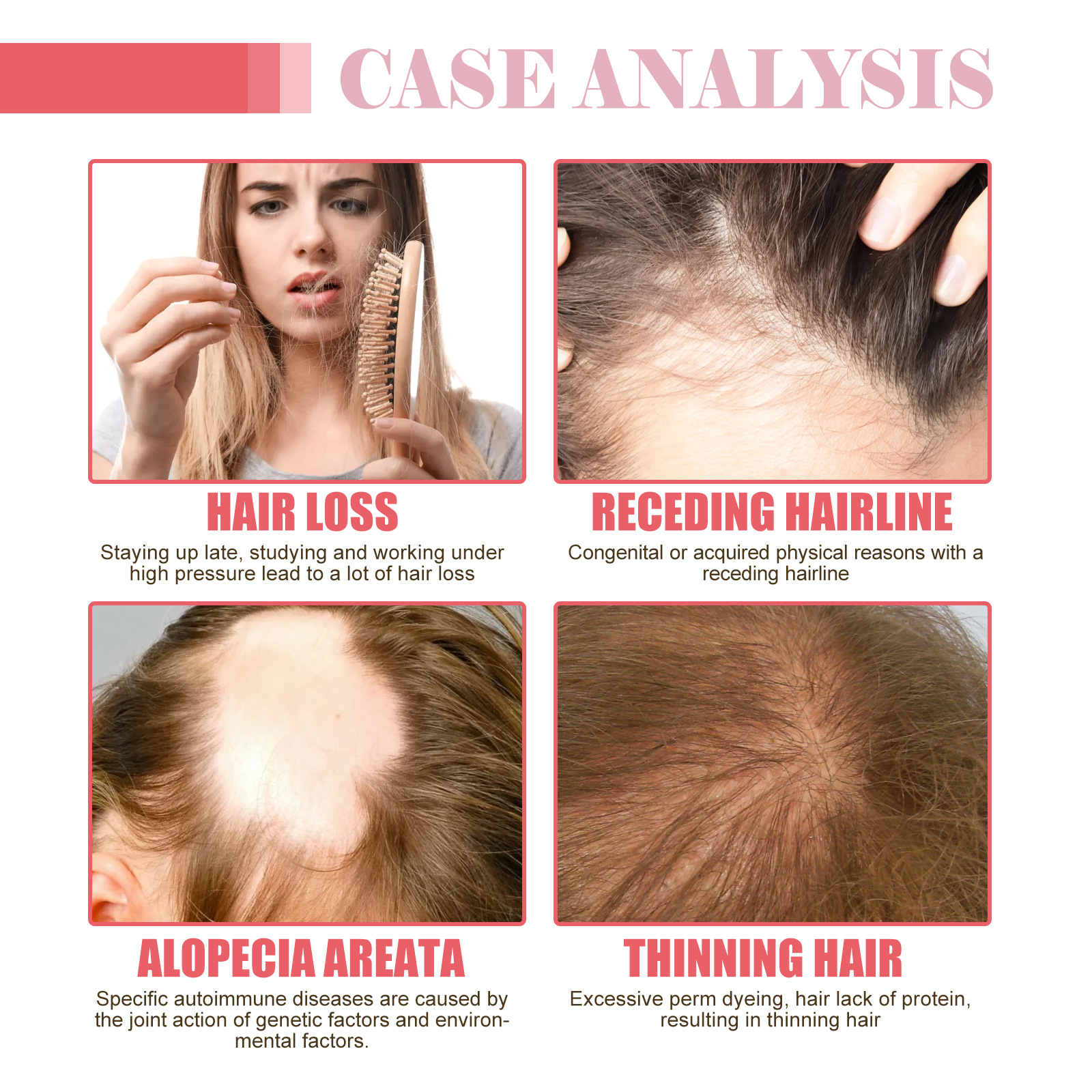 EELHOE Ätherisches Öl für dickes Haar spendet Feuchtigkeit, repariert trockenes und krauses Haar, nährt das Haar, beugt Haarausfall vor und stabilisiert das Haar_voghion.com