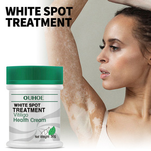 OUHOE White Spot Repair Cream Repair Desalination White Spot Spot Melanin Hand and Foot Skin Moss Skin External Care Cream