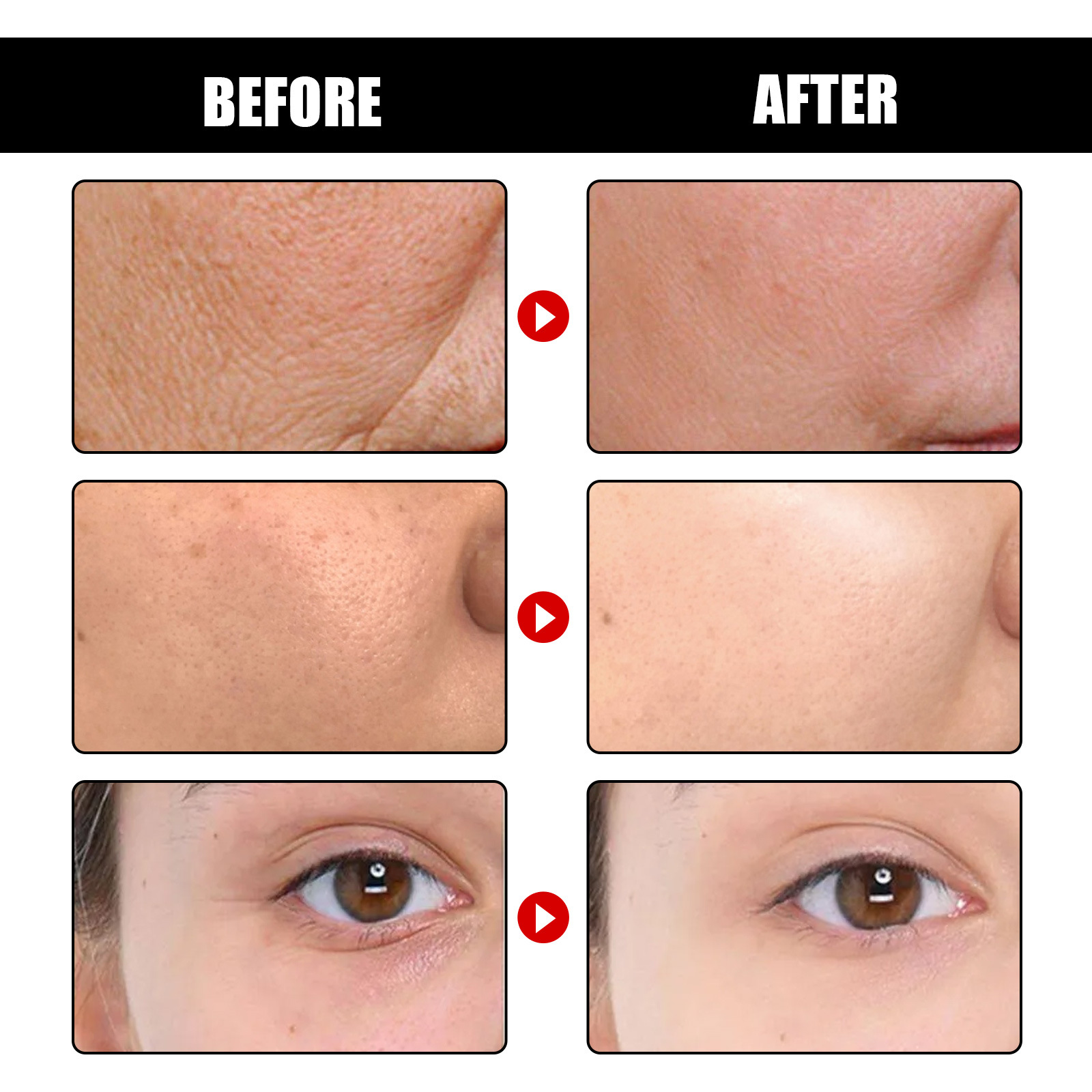 EELHOE Deep Anti Wrinkle Liquid Facial lifting firming, fade fine lines, anti-aging, moisturizing and skin care essence_voghion.com