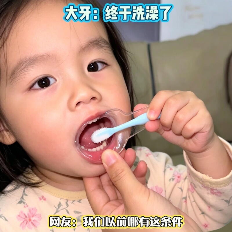 Baby's Toothbrushing Tool! Children's Oral Mouth Opener, Toothbrushing Aid, Expander, Dental Dirt Cleaning Gadget Baby's Toothbrushing Tool! Children's Oral Mouth Opener, Toothbrushing Aid, Expander, Dental Dirt Cleaning Gadget
