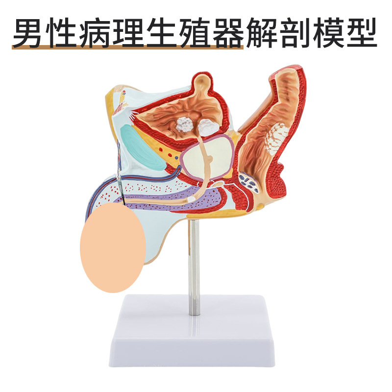 ����������ֳ����ģ�� ��̬������ֳ����ģ�� غ��ģ�� ����ģ��