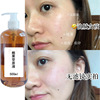 Arbutin Freckle Melanin Desalination Stain Chloasma Beauty skin whitening Essence liquid wholesale