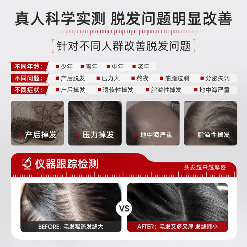 三个魔发匠可比落防脱韧发控油洗发水强根健发洗发乳【工厂直发】|undefined