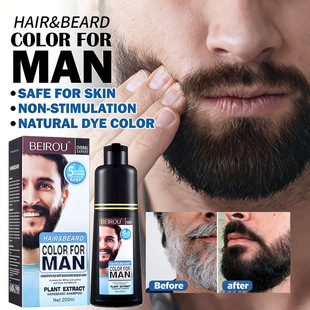 �׷���Ⱦ�l�����Zֲ��ں��Ӻ��Ⱦ�l��Ⱦ����Ⱦɫ���aƷ�ڰ��oɫ