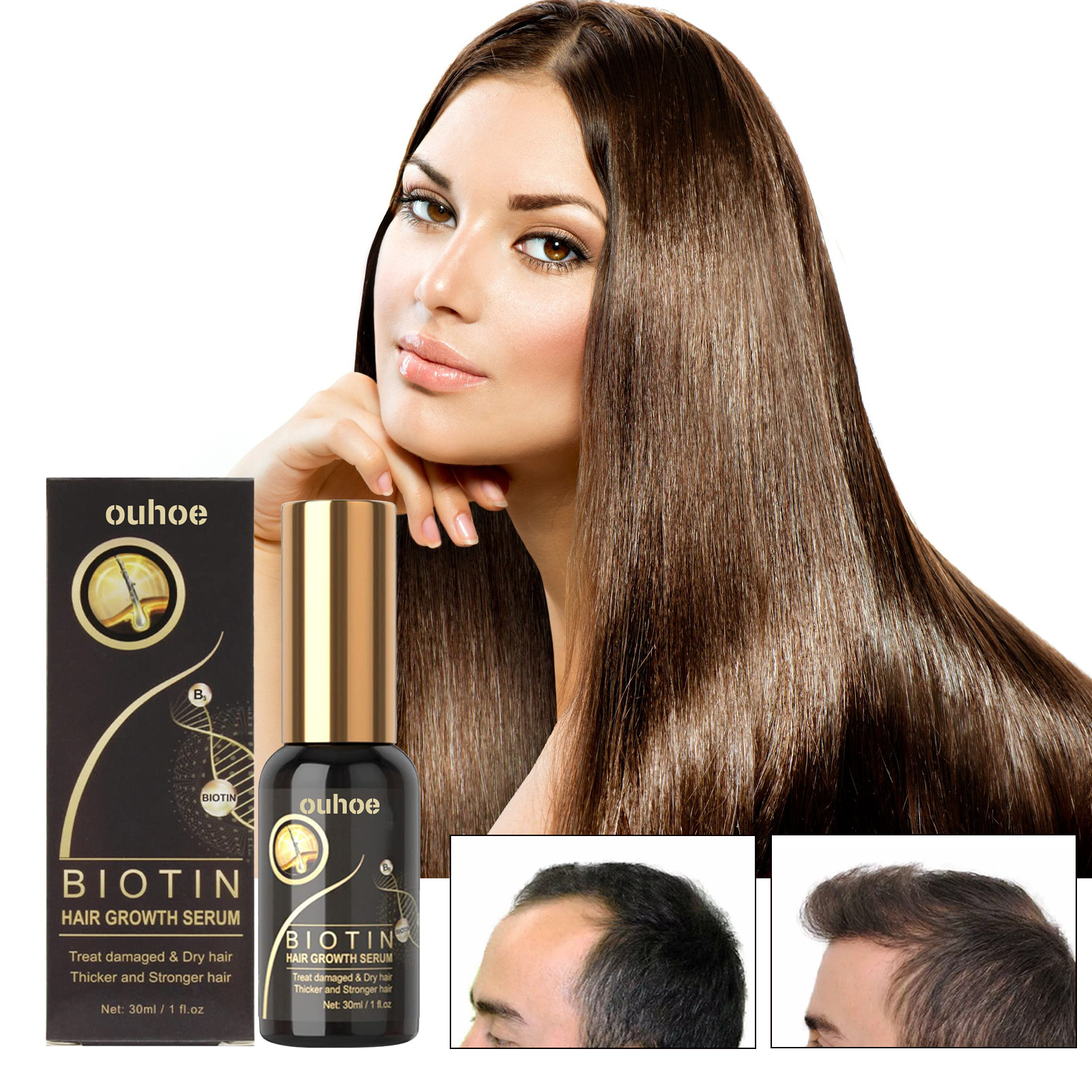 OUHOE Biotin Moisturizing Root Dense Repairing Hairline Strong and Firm Hair Essence_voghion.com