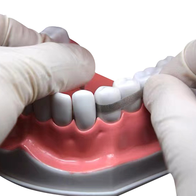 Material dental Brasil superficie adyacente esmalte eliminación de pulido tira rebanada tira de arena diente abierto Junta superficie metálica pulido tira molar conjunta