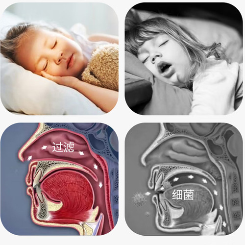 Closed mouth breathing correction mouth breathing corrector Children's sleeping open mouth breathing correction closed mouth patch