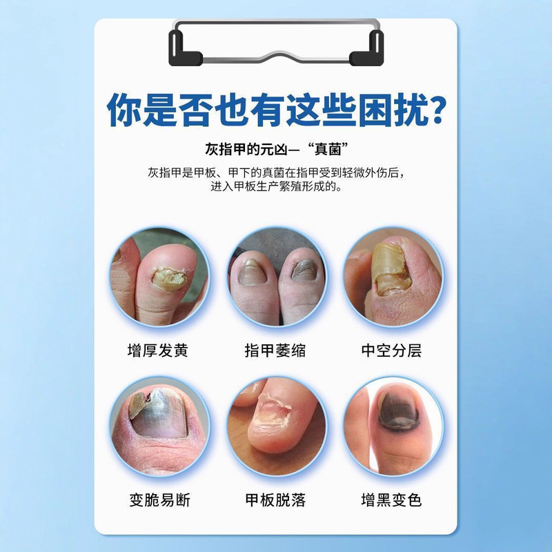 香港薬局爪真菌症液体爪肥厚水虫スプレーブライトニング爪真菌症フットケアソリューションメーカー在庫あり|undefined