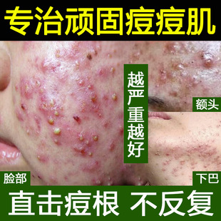 �ݱ�����AҺ������ӡ�����]�ڷ۴��տsë������Ժˮ�����ˮ